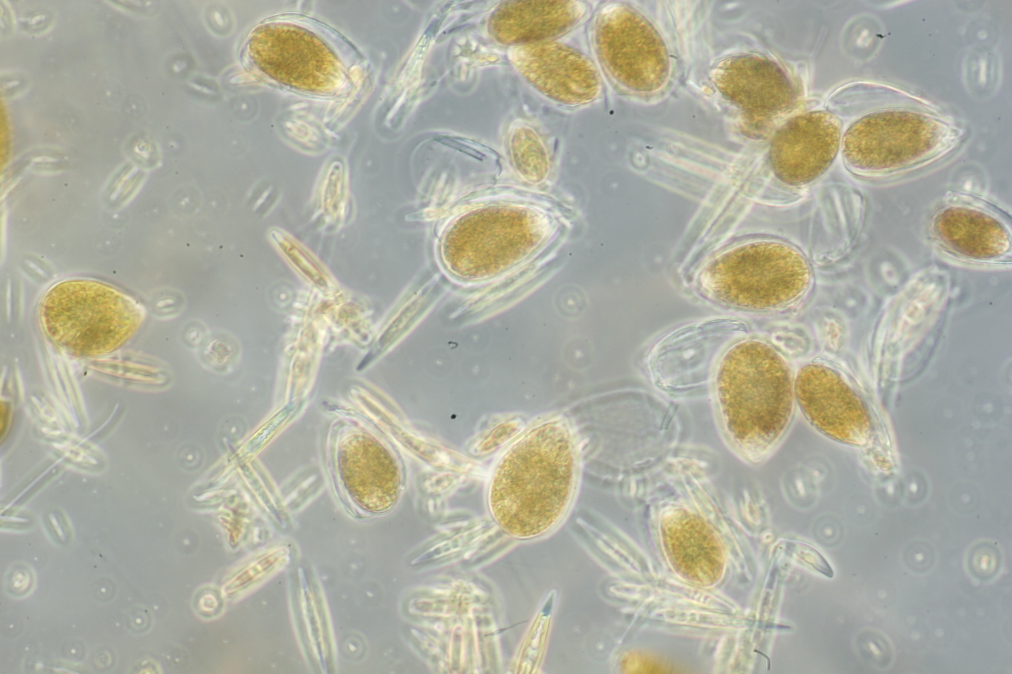 ostreopsis cf. ovata una dinoflagellata bentonica produttrice di biotossine, responsabile di imponenti fioriture associate a intossicazioni umane e morie di organismi marini
